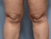 knie-1.jpg