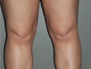 knie-2.jpg